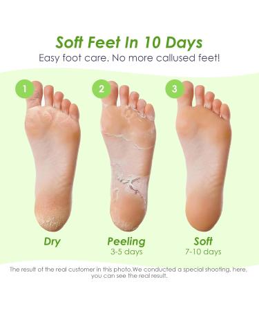 Exfoliating Foot Mask - 2 Pairs of Cornea Socks for Men & Women | Effective Foot Care for Tender Feet | Vera Green - Buy Online on GoSupps.com