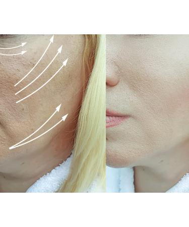 Neuropeptide & Growth Factor Wrinkle Serum - Brightening Antioxidant Collagen Peptides & Hyaluronic Acid for All Skin Types - Reduce Fine Lines & Premature Aging - 1oz - Buy Online on GoSupps.com