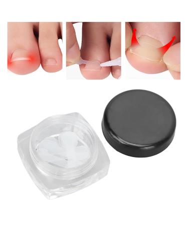 10 Pcs Painless Ingrown Toenail Correction Strips - Fix Paronychia Fast | International Shipping Available - Buy Online on GoSupps.com
