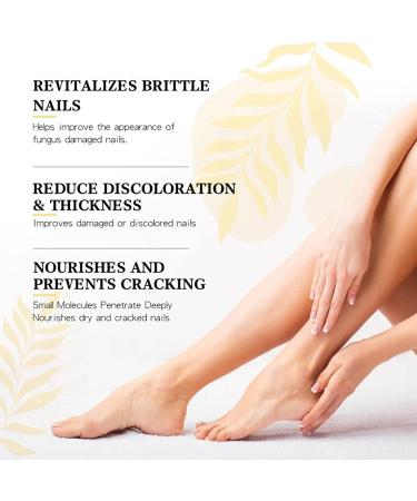 Flysmus 7 Days Nail Recovery Rapid Growth Essence Pen Natural 7 Days Nail Growth and Strengthening Serum Nail Growth & Strengthening Oil Serum for Thin Nails and Growth 20ml (3PCS) - Buy Online on GoSupps.com