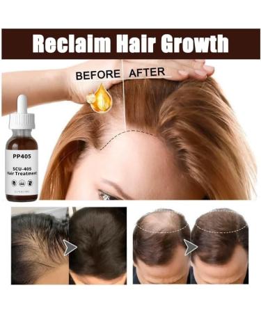 PP405 Huile nourrissante des cheveux | S rum pour les cheveux claircissants | Formule non grasse absorbante rapide | pour les femmes et les hommes 1PCS 200 g (Lot de 1) - Buy Online on GoSupps.com
