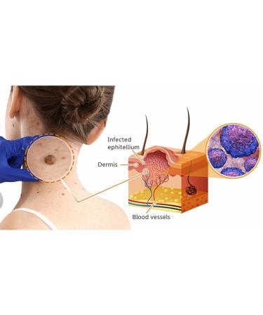 FROPUN Bee Venom Removal Cream - 100% Natural Fast-Acting Repair Cream for Adults - Maximum Strength Skin Care for Men & Women (1 Floz - Buy Online on GoSupps.com