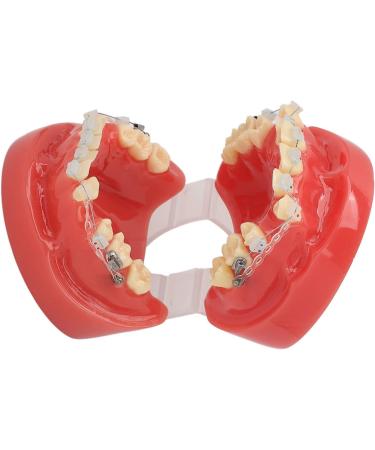 Orthodontic Model 24 Teeth with Metal Wire Case - Ideal for Dental Hospitals | International Shipping Available - Buy Online on GoSupps.com