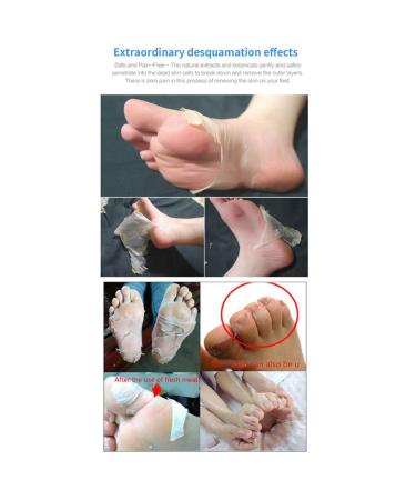 Onkessy Foot Peel Mask - Exfoliating Dead Skin Feet Repair Treatment - For Men and Women - Pedicure Spa - 1 Pair - Buy Online on GoSupps.com