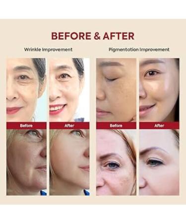  G n rique RETINAL Serum - Seoul 1988 Anti-Aging Serum 2% Liposome Retinol with Black Ginseng Elasticity and Pore Care - Made in Korea - Buy Online on GoSupps.com