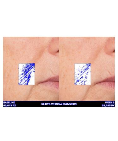 Serious Skincare Ultra-Mare Pure Marine Infusion Trio | Anti-Aging Serum Facial Cream & Eye Cream with Algae & Plankton Extracts Global Shipping - Buy Online on GoSupps.com