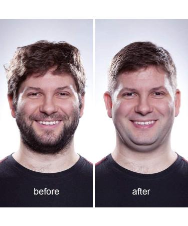 Buy Ear and Nose Hair Trimmer for Men & Women - 4 in 1 Electric Eyebrow Trimmer & Waterproof Facial Hair Remover - Buy Online on GoSupps.com