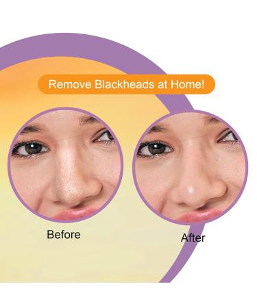 Generic Nose Pore Strips | Deep Cleansing & Painless Blackhead Removal | 10 PCS with Vitamin C | International Shipping Available - Buy Online on GoSupps.com