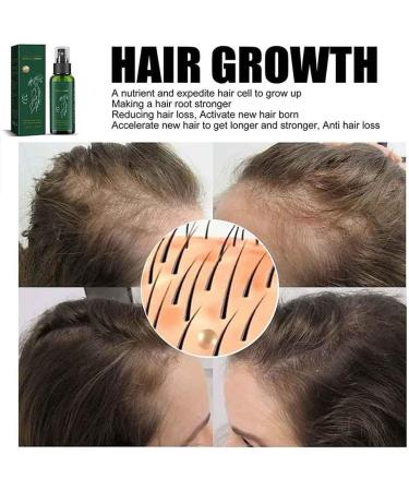 S Rum De Croissance Des Cheveux Au Ginseng En Spray Pour Hommes Et Femmes S Rum De Repousse Des Cheveux Au Gingembre Pour La Perte De Cheveux L' Claircissement Des Cheveux (3pcs) - Buy Online on GoSupps.com