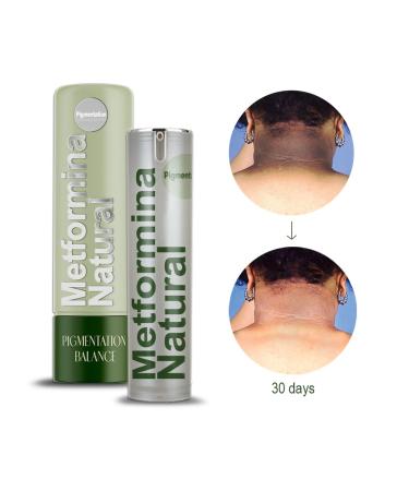 Metformina Natural Cream - Fade Dark Spots on Face & Body (2-Month Supply) | Best Skin Care Solution - Buy Online on GoSupps.com