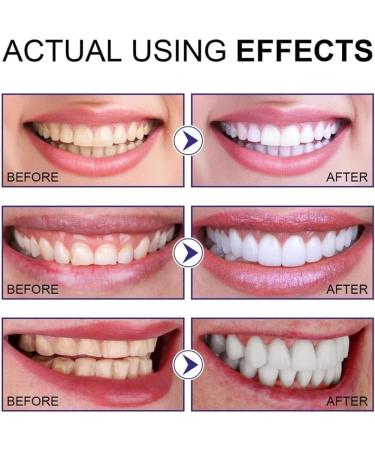 Aiposhiy Teeth Whitening Powder Natural Teeth Whitening Powder Tooth Cleaning Powder Mint Whitening Teeth Deeply Cleans Stains and Dirt and freshens Breath (2pcs) - Buy Online on GoSupps.com