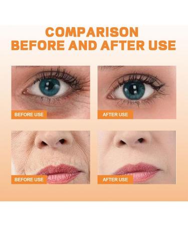 Dajidafu Portable Eye Dark Circle Spray Anti-age Anti-wrinkle Mist Sprays Moisturizing Hydrating Sprayer Wrinkle Remover Skin Care - Buy Online on GoSupps.com
