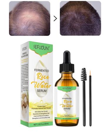 Hair Growth Oil  Rice Water Serum for Thin Hair and Hair Loss Treatments  Rice Essential Oil for Damaged Dry Hair  All Natural Hair Oil for Stronger Thicker Longer Hair  All Hair Types  Men and Women
