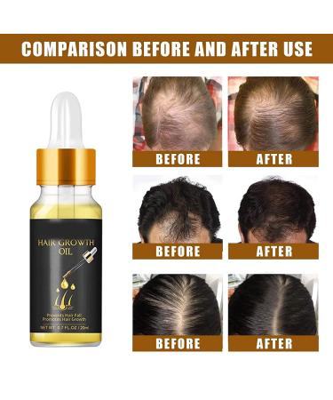 PopiHair Growth Serum - Biotin Herbal Thickening Serum (2pcs) - Buy Online on GoSupps.com