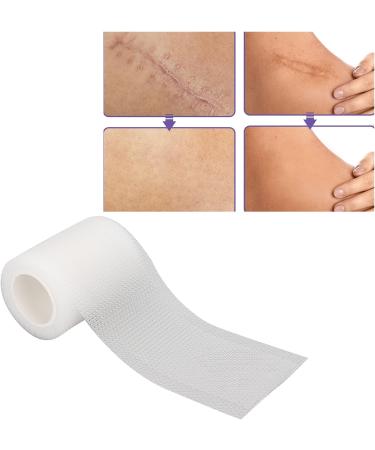 Silicone Scar Removal Tape Roll for Hypertrophic Scars - Post Surgery, Acne, Burns - Caesarean Section Safe - Buy Online on GoSupps.com