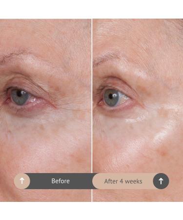 Consult Beaute Volumagen - Collagen Facial Serum Concentrate for Nourishing & Plumping Skin - Hydrates and Temporarily Fills for Smoother Bouncy Skin - Hyaluronic Acid & Vitamin C - 2 Fl. Oz. 2 Fl Oz (Pack of 1) - Buy Online on GoSupps.com