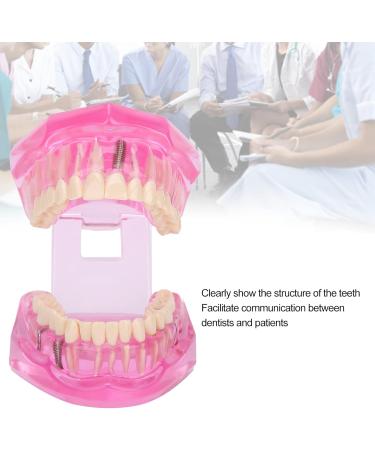 Dentalmodell f r Erwachsene - Klar Zahnmodell f r Studium & Unterricht | Internationaler Versand - Buy Online on GoSupps.com