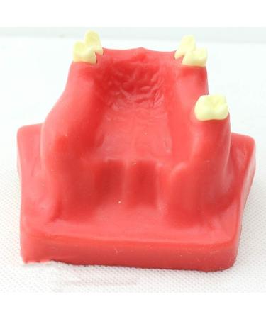 LBYLYH Dental Oral Model & Jaw Implant Surgical Model - Breast Lift Operation Training Tool - Buy Online on GoSupps.com