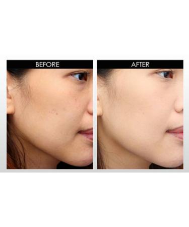 DNA Code -20% Vitamin C + Coq10 Facial Cleanser Powered w/Hyalurinic Acid + Matrixyl 3000 + Green Tea 4 Count (Pack of 1) - Buy Online on GoSupps.com