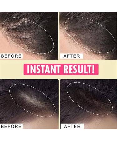 Instant Hairline Powder & Concealer Pen for Quick Hair Root Coverage - Black Hairline Shadow - Buy Online on GoSupps.com