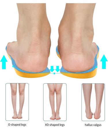 Buy Supination Insoles for Flat Feet & O/X-Leg Support | Orthopedic Inserts for All-Day Comfort (Size 41-42 - Buy Online on GoSupps.com