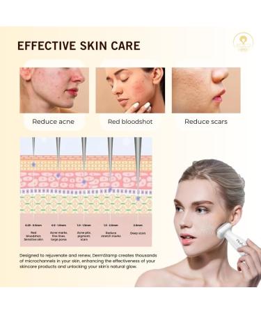 Misplaced Roots Derma Stamp 120 Real Stainless Steel Needle Adjustable Length 0-2mm Professional Quality Microneedle Skin Care at Home Effective for Hair loss Wrinkles & Scars - Buy Online on GoSupps.com