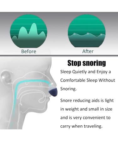Electric Anti-Snoring Device for Men and Women - Adjustable, Portable, Blue Plastic - Buy Online on GoSupps.com