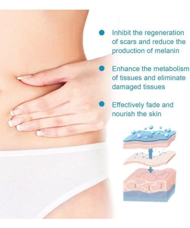 Waitlover Scar Removal Cream Gel - 20g | Repairs Pock Marks, Burns, Surgical Scars, Cesarean Scars & Stretch Marks | Moisturizes & Smoothens Skin - Care Mark Treatment - Buy Online on GoSupps.com