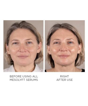 Power Combo Neck & Eye Roller - Brightening Anti-Aging Face Serums & Best Lip Plumper for Multi-Purpose Skin Care - Buy Online on GoSupps.com