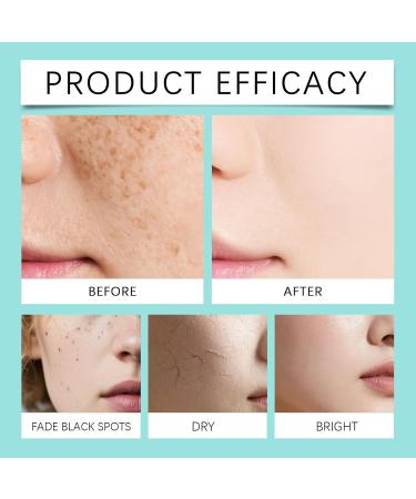 Cr me Hydratante Avanc e For Le Visage : Nourrit Et Hydrate La Peau Am liore La Texture R duit Les Imperfections - Soin Adoucissant Quotidien - Buy Online on GoSupps.com