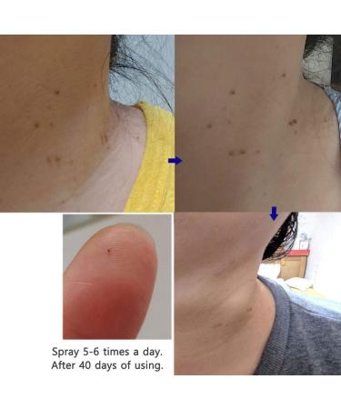 Dr. Deep Skin Toner - Hydrating Alcohol-Free Korean Toner Spray for Sensitive & Dry Skin | Aloe Vera Face Toner 6.76 fl. oz - Buy Online on GoSupps.com