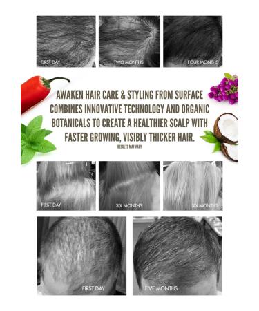Surface Hair Awaken Kit: Shampoo, Conditioner, Scalp Elixir & Treatment for Thinning Hair, Hair Loss & Thickening - Buy Online on GoSupps.com