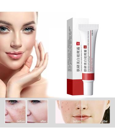 SGHOPLG 3Pcs Effective Whitening Freckle CreamRemove Melasma Acne Cream Fading Spot CreamAcne Scar Removal TreatmentFade Pigmentation Anti Melasma Brighten Skin Care Creams - Buy Online on GoSupps.com