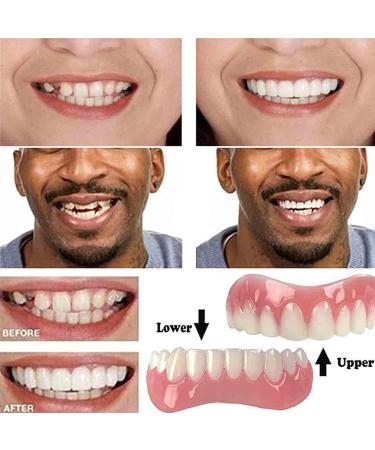 Buy High-Quality Dentures & Cosmetic Veneers | Temporary Prosthesis & Silicone Tooth Prots for Men & Women - 1PCs - Buy Online on GoSupps.com