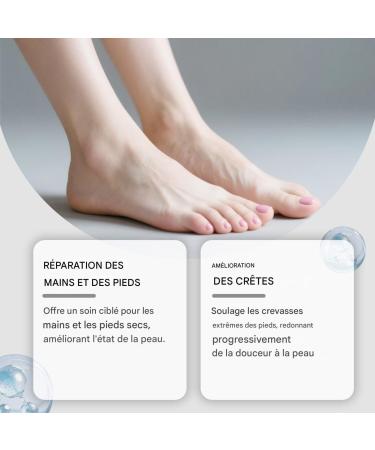 Hand Moisturizer Anti-Freeze Heels Repair Lotion Dry Foot Cream For Dead Skin Women Men Elderly Sports Toes Elbows Autumn - Buy Online on GoSupps.com