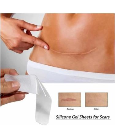 Professional Scar Remover Strips - Reusable Silicone Patch for Stretch Marks - 9.8ft Clear Concealed Sheets for Mild & No Irritating Scar Removal - Buy Online on GoSupps.com