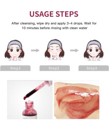 FunnAura AHA 30% + BHA 2% Peeling Solution Exfoliating Facial Serum Fighting Blemishes Reduces Pore Congestion(30 Ml) - Buy Online on GoSupps.com
