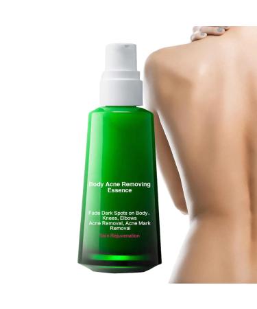 Brightening essence facial essence for pale skin |With vitamins enriched natural facial aluminum essence remover of eye circles restoration of elasticity for all visiblurry