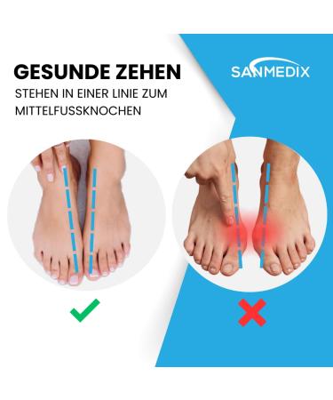 SanMedix Hallux Valgus Toe Spreader Training Band - Pain Relief Correction Set for Women & Men - Buy Online on GoSupps.com