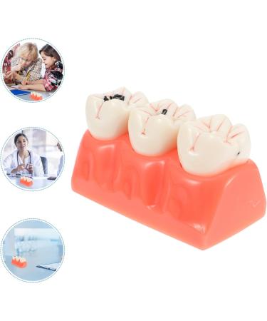 Ultechnovo Dental Recovery Tool Set - 2 Caries Tooth Models for Teaching & Demonstration | 12.5x7x6.5cm - Ideal for Dentistry Education - Buy Online on GoSupps.com