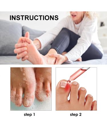 Ingrown Toenail Treatment Drop Ingrown Toenail Treatment Ingrowth Toenail Correction Treatment Oil Correction Ingrown Toenail Drops Cuticle Care Oils For Ingrown Toenails Fungal Toenail Treatment - Buy Online on GoSupps.com
