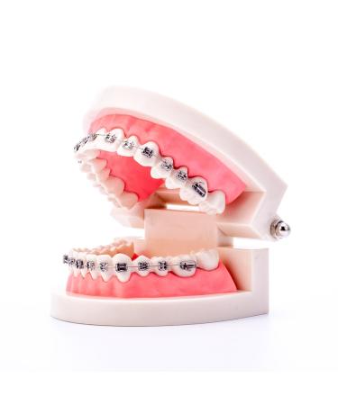 Dental Orthodontic Standard Teeth Model With Metal Brackets Wires