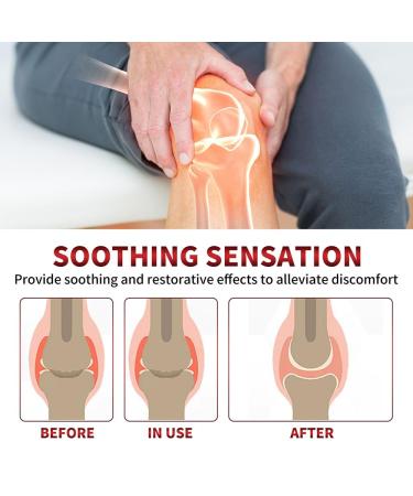 Buy Todahof Bee Venom Ointment - Fast Relief for Joint Pain | International Shipping Available - Buy Online on GoSupps.com