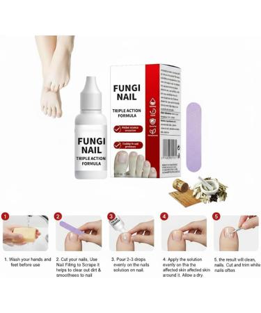 Toenail Fungus Treatment Overnight Long Lasting Nail Treatment for Athletes Foot Thick Broken Discolored and Damaged Nails 15 Ml05 Oz 1 pcs - Buy Online on GoSupps.com