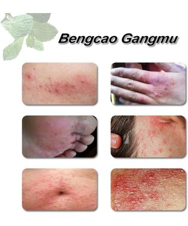 MCXNCXGD Dermatitis Inflammation and Rashes Body Cream 4 Count (Pack of 2) - Buy Online on GoSupps.com