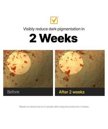 Cell Fusion C Toning C Vita Shot Ampoule, Brightening Vitamin C Serum for Face with Spicules, Zero Dark Spots & Glow Serum for Sensitive Skin, 20g / 0.7 oz. - Buy Online on GoSupps.com