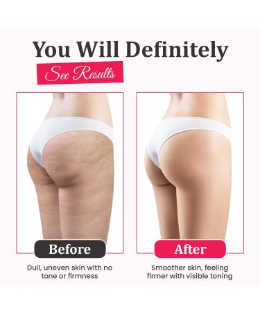Anti Cellulite Massage Oil Body Massage Oil Collagen and Stem Cells Butt Firming and Lifting Cream Leg Firming and Tightening Cream Body Scrubber Massager - Buy Online on GoSupps.com