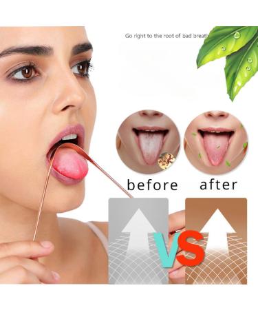 Buy Copper Tongue Scraper - Eliminate Bad Breath | Travel-Friendly Oral Care | Fresh Breath Solution for Adults - Buy Online on GoSupps.com