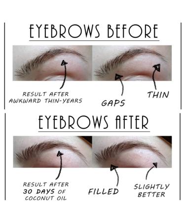 NatureCall Coconut Oil for Eyelash & Eyebrow Growth - 10ml Bottle | Best for Fuller Lashes & Brows - Buy Online on GoSupps.com