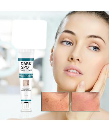 Dark S Corrector Cream Whiten S Moisturizer Skin Brightening Cream Facial Brightening Moisturizer Deep Skin Brightening Skin Tone Corrector Dark Remover Age S Cream - Buy Online on GoSupps.com
